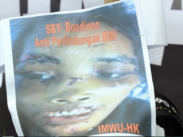 الضحية خضعت لعمليات زرع جلد في مستشفى الملك فهد  اعتقال سعودية طعنت خادمتها بالمقص وأحرقتها بالمكواة