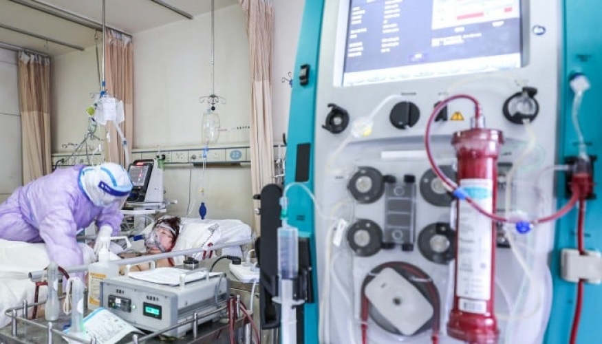 دخول جهاز دعم حياة (ايكمو) يعمل بتكنولوجيا الصواريخ إلى السوق الصينية 