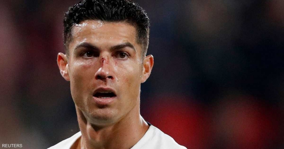 رونالدو مصابا في رقبته.. والتشخيص المبدئي يكشف؟