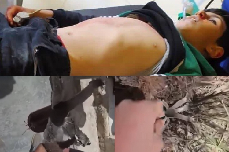 مقتل طفل وإصابة والده بانفجار لغم بريف حماة الشمالي