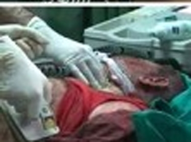 ارتفاع حصيلة الاعتداء الارهابي على حافلة العمال بحمص إلى 4 شهداء و7 جرحى والاتحاد يدين