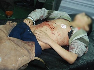 Child Martyred in Explosive Device Blast in Damascus, a Law Enforcement Member Shot Dead in Homs 